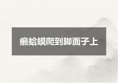 癞蛤蟆爬到脚面子上
